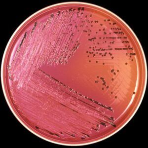 cultivo salmonella