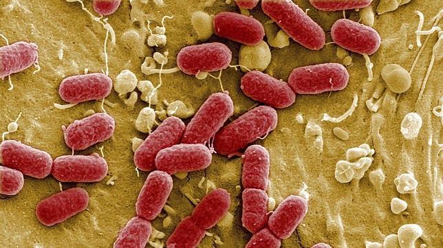 e. coli