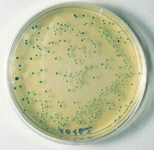 e.coli