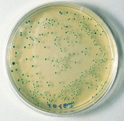 e.coli