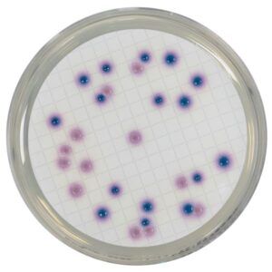 Cromogénico para Coliformes Agar (CCA)