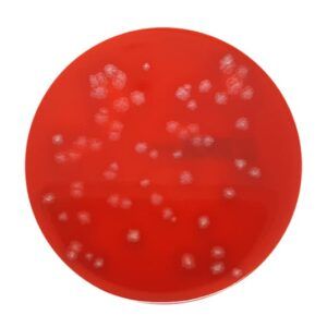 Columbia Blood Agar