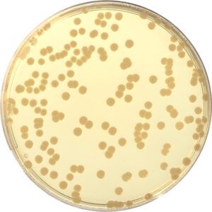 Plate Count Agar (PCA)