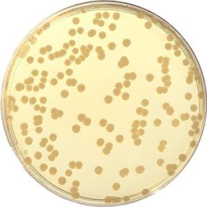 Trypto - Casein Soy Agar (TSA)