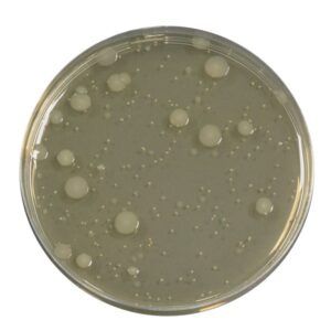 El Yeast Extract Agar es un medio nutritivo general para una amplia variedad de usos.