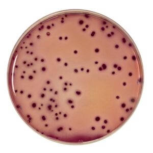 El Agar VRBG Agar Bilis Glucosa con cristal violeta y rojo neutro está descrito para la detección y recuento de enterobacterias en todo tipo de alimentos. BIOSER es el distribuidor oficial de Biokar