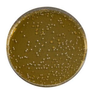 El MRS Agar es un medio de cultivo normativo destinado al crecimiento y recuento de Lactobacillus en la industria láctea principalmente.