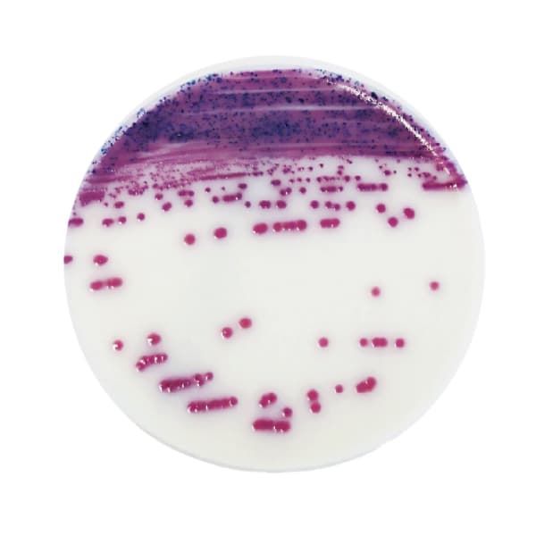 El IRIS Salmonella Supplement es un complemento que debe ser añadido al Salmonella Enrichment que permite eliminar la flora acompañante y favorecer el desarrollo de Salmonella.