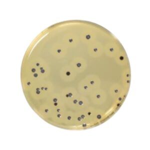 Baird-Parker Agar Medio Base es el medio selectivo para la detección y recuento de Staphylococcus coagulasa positivos en muestras varias del sector agroalimentario. Para más información contactar con Bioser en el 932264477
