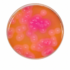 Egg Yolk Enrichment