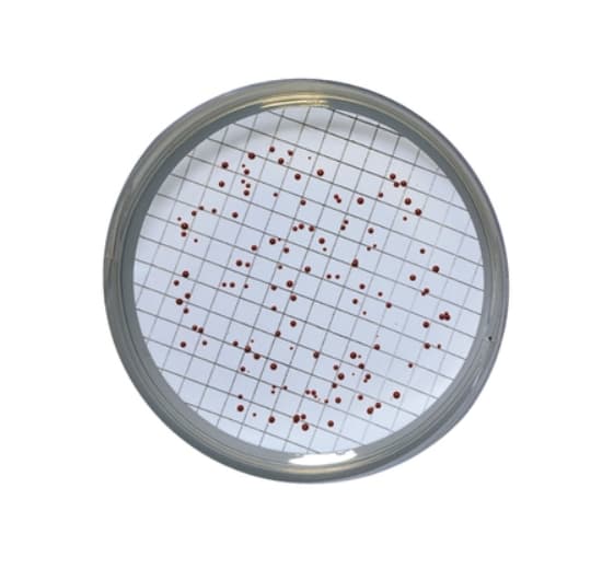 El Slanetz And Bartley Agar es un medio selectivo utilizado para la enumeración y recuento de enterococos en muestras de agua tanto por el método de filtración por membrana como por el método de recuento en placas. Para más información contactar con Bioser en el 932264477