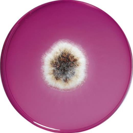 El Rose Bengal Chloramphenicol Agar es un medio sólido selectivo destinado al recuento y aislamiento de mohos y levaduras en muestras de origen medio ambiental y alimentario. Para más información contactar con Bioser en el 932264477