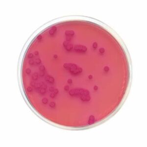 El MacConkey Agar Nº3 se trata de un medio selectivo y diferencial para la detección de Coliformes en productos para el consumo humano humano y animal así como Salmonella en muestras clínicas.