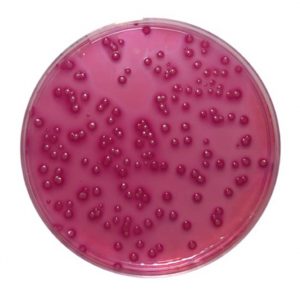 VRBG (Violet Red Bile Glucose Agar)