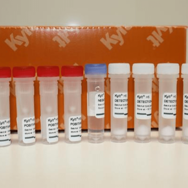 El Kit de DetecciÃ³n de Factores de Virulencia E. coli EAST