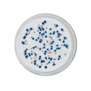 El CCA Coliforms Chromogenic Agar se trata de un medio selectivo y diferencial para realizar detección de coliformes y E. coli en muestras de agua destinadas al consumo humano obtenidas gracias al método de filtración por membrana. Para más información contactar con Bioser en el 932264477.