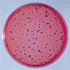 El Agar Bilis Glucosa con cristal violeta y rojo neutro (Agar VRBG) en placas de contacto (o Rodac) sirven para monitorizar la limpieza y desinfección de las superficies de trabajo en industrias y laboratorios. BIOAGAR es marca propia de BIOSER