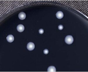BCYE Agar sin Cisteína para Legionella