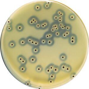 El enriquecimiento Egg Yolk Tellurite conjuntamente con el Baird-Parker Agar se emplean para la detección y recuento de Staphyllococcus aureus en muestras procedentes de la industria agroalimentaria. Para más información contactar con Bioser en el 932264477
