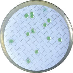 El Agar CN para Pseudomonas es un medio selectivo destinado al aislamiento de Pseudomonas en aguas mediante una rampa de filtración. Para más información contactar con Bioser en el 932264477