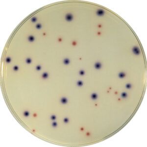 COMPASS® Ecc Agar es un medio cromogénico selectivo para el recuento simultáneo y específico de Escherichia coli y coliformes en muestras de alimentos (incubación a 37ºC durante 21 horas). Para más información contactar con Bioser en el 932264477