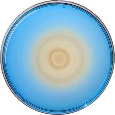 SESAME Salmonella TEST es un método alternativo para la detección de Salmonella en  alimentación humana y anima