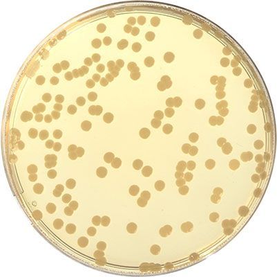 El Agar Triptona-Soja TSA es un medio nutritivo general para el crecimiento y aislamiento de bacterias aeróbicas y anaeróbicas. Para más información contactar con Bioser en el 932264477