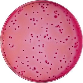 El Agar Violeta Rojo Bilis es un medio selectivo para la detección y recuento de coliformes destinado a productos de la industria agroalimentaria. Para más información contactar con Bioser en el 932264477