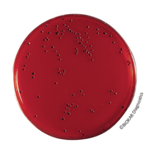El Agar XLD (Xilosa Lisina Desoxicolato) se utiliza para aislar enterobacterias patógenas