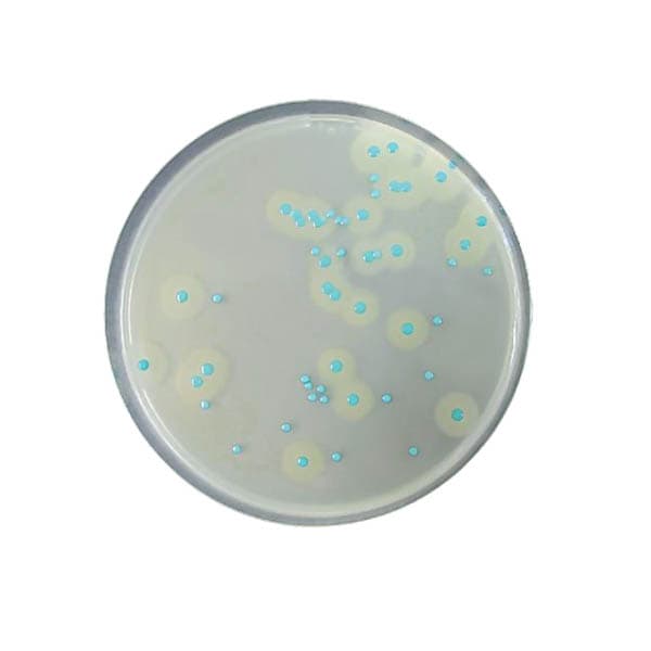COMPASS® Listeria Agar es un medio selectivo usado para la detección y enumeración de Listeria monocytogenes en alimentación y muestras ambientales principalmente. Para más información contactar con Bioser en el 932264477